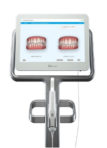 クリンチェック導入